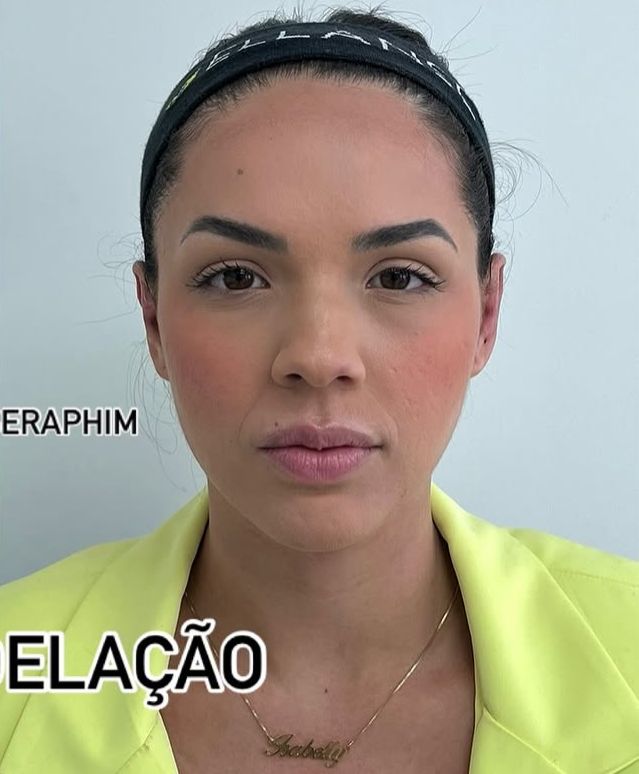 Depois
